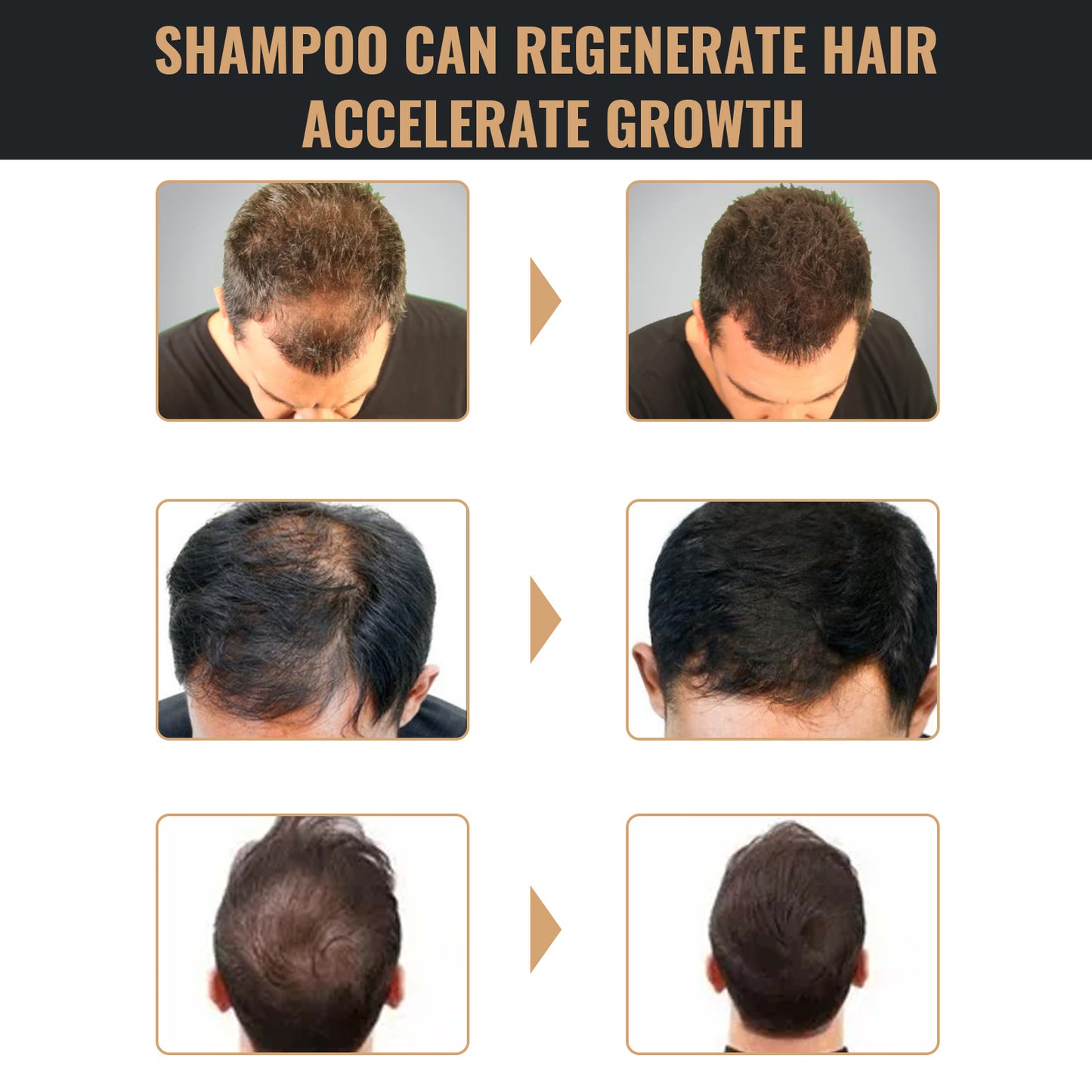 Root Boost Hair Revival Shampoo – Regrow, Nourish & Thicken