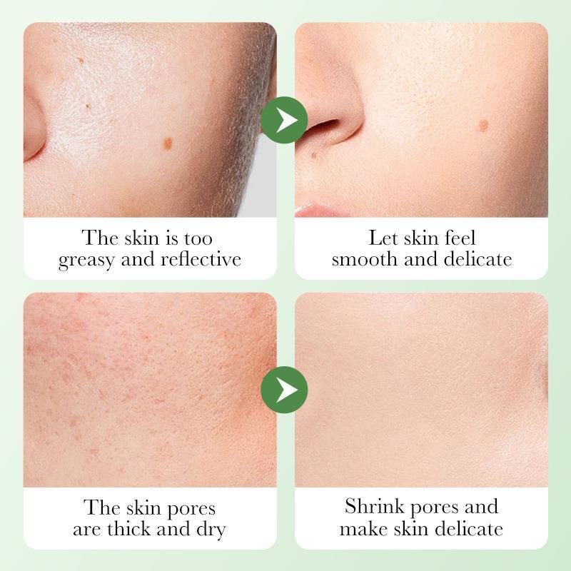 Before and after comparison of skin care treatment effects on a person's face.